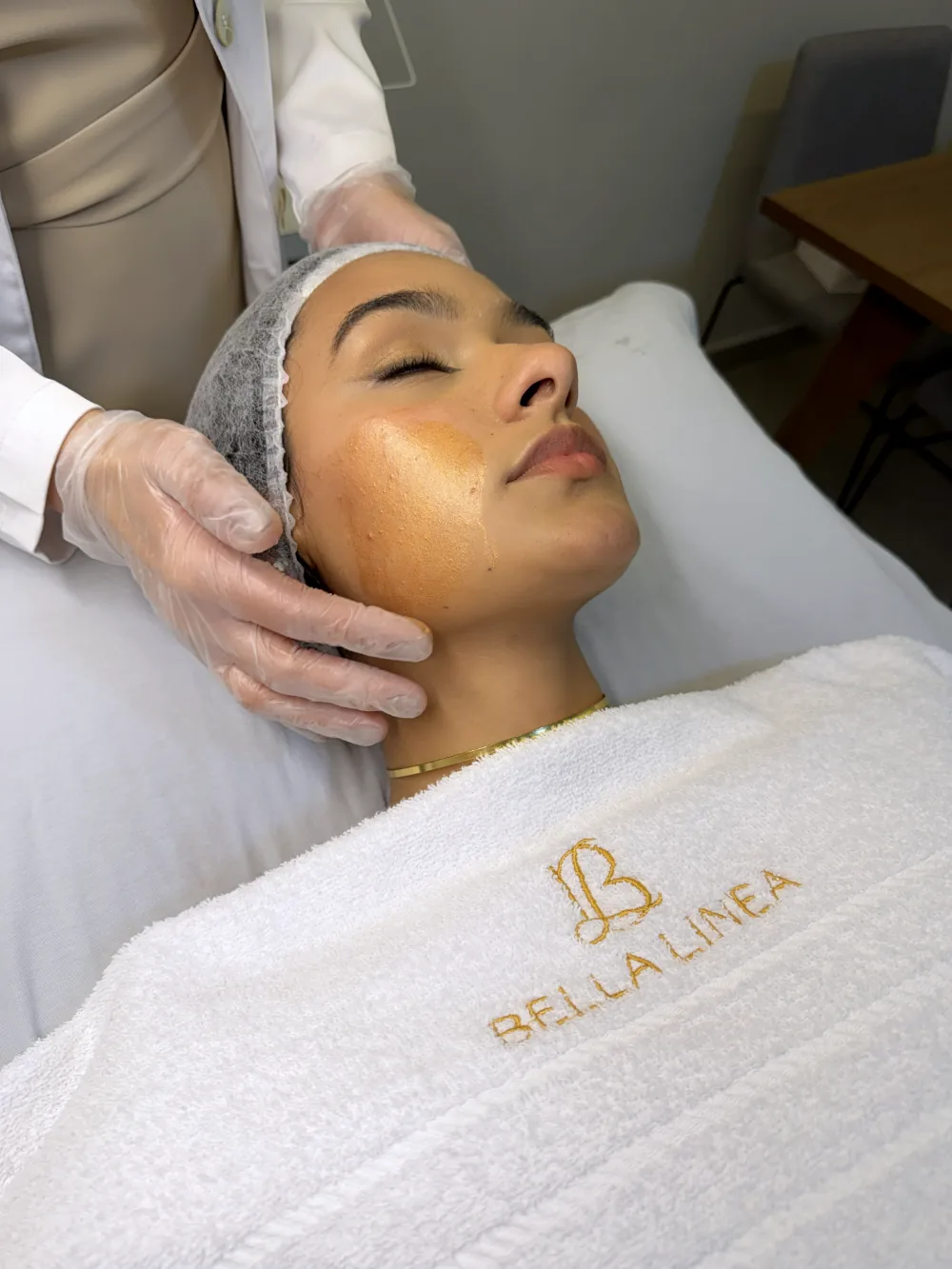 Tratamento de manchas faciais na Bella Linea